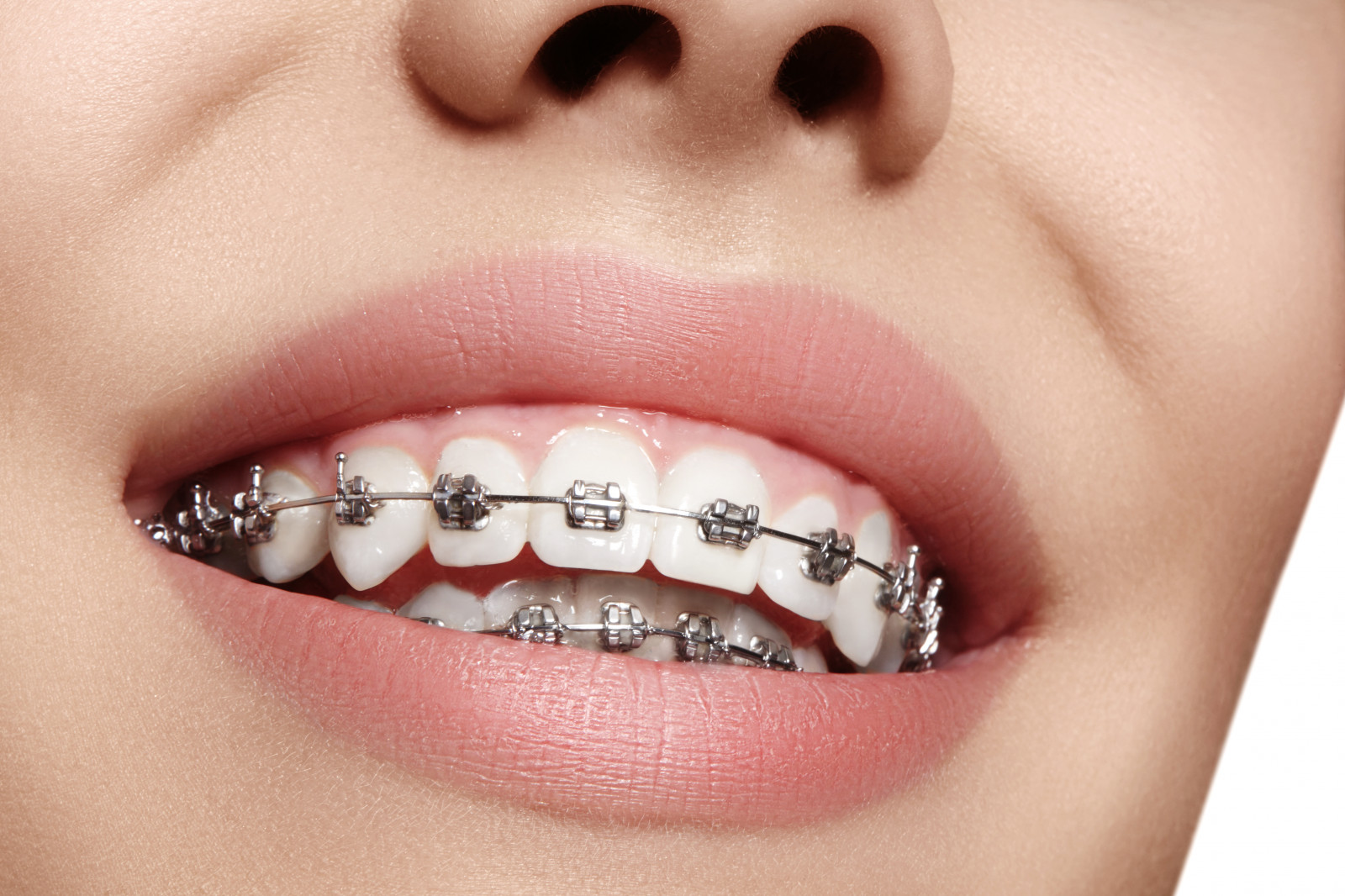 Orthodontist-dentist