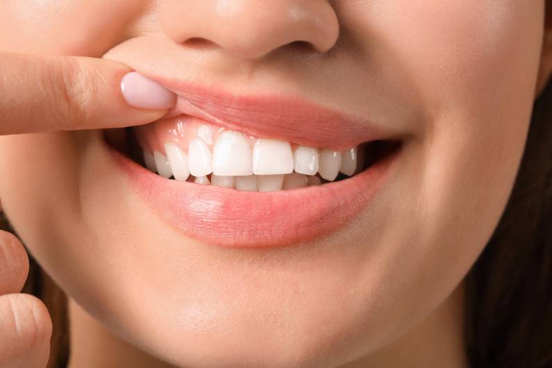 gums-and-teeth